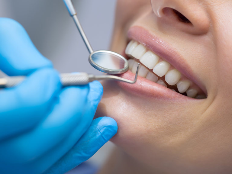 Dentist examining a patients t