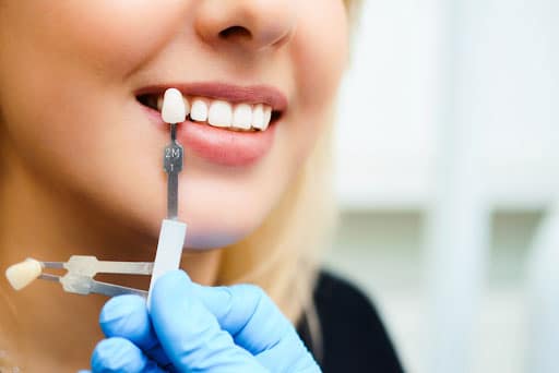 Affordable Cosmetic Dentistry